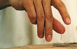 צילום: לי קוברסקי
