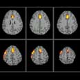 סריקת MRI של פעילות עצבית המתרחשת כשאדם משקר. 