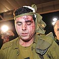 אחד הפצועים צילום: ג'ורג' גינסברג