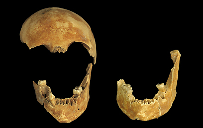 שרידי גולגולת שנמצאה בבאר העתיקה (צילום: קלרה עמית, רשות העתיקות) שרידי גולגולת שנמצאה בבאר העתיקה (צילום: קלרה עמית, רשות העתיקות)