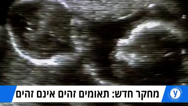ynet